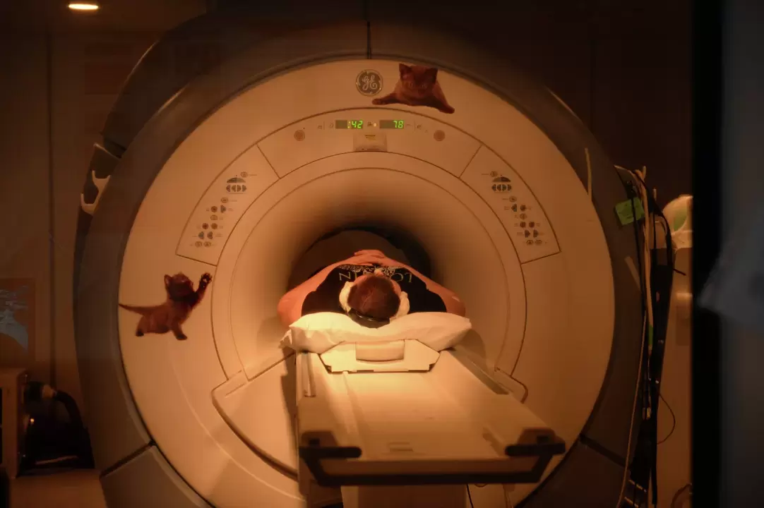A mágneses rezonancia képalkotás a leghatékonyabb módszer a nyaki osteochondrosis diagnosztizálására