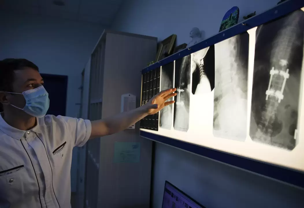 Az orvosok műszeres módszerekkel, például radiográfiával diagnosztizálják a nyaki osteochondrosist